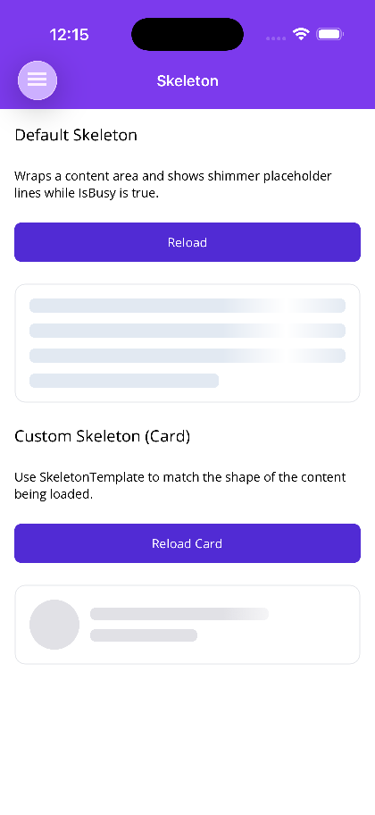 Line and card skeleton placeholders while IsBusy is true
